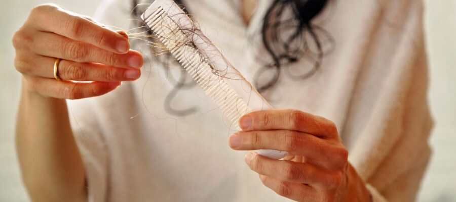 Does Diet Affect Hair Loss